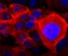 Researchers discover mechanism that enables cancer cells to move throughout the body