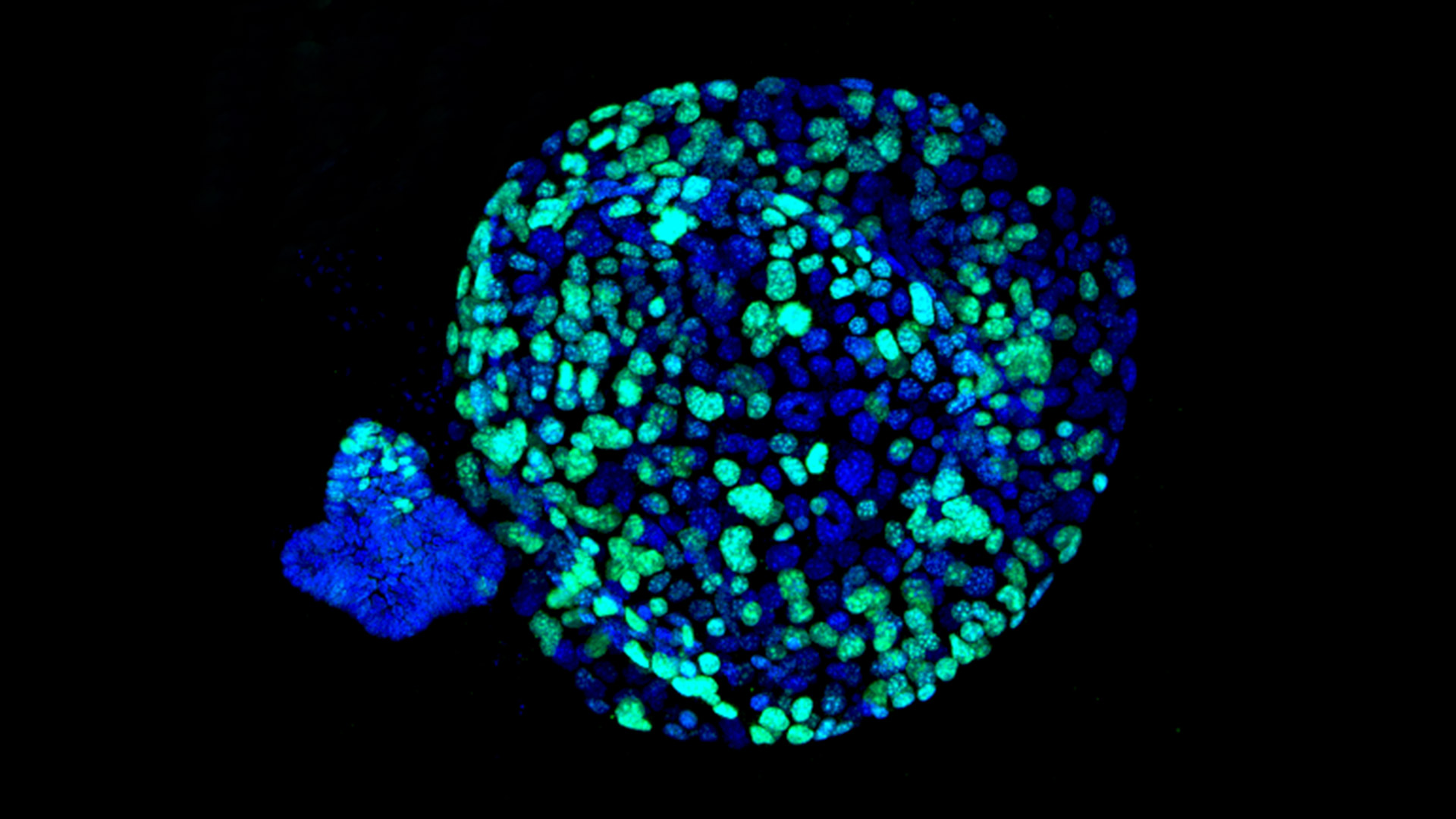 Organoids Accurately Predict Treatment Response of Pancreatic Cancer Patients
