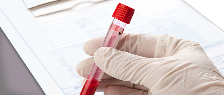 Study Shows Blood Test Can Detect 8 Types of Cancer